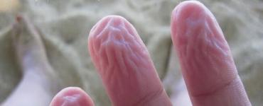 Как защититься от инфекционных заболеваний Организм человека защищается